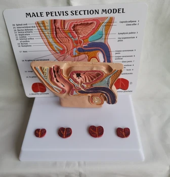 Human Мъжко тазово сечение Коремна кухина Пикочен мехур Простата Медицински Модел на преподаване Здраве Сравнение на заболяванията Анатомичен модел